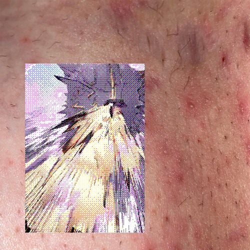 Dysphoria