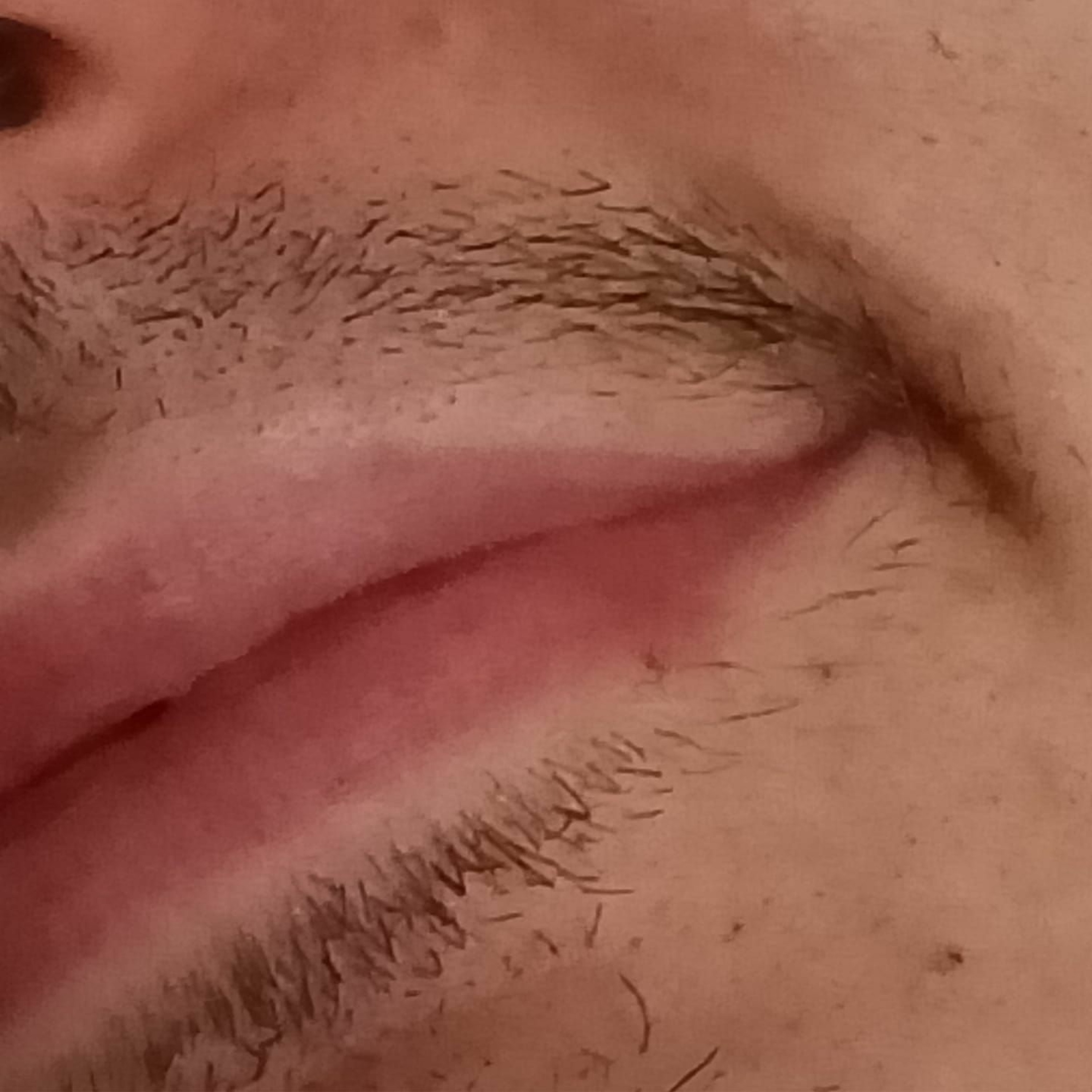 KapotKast