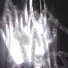scars +eloter
