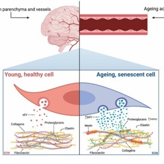 Senescence and Extracellular Vesicles: Novel Partners in Vascular Amyloidosis