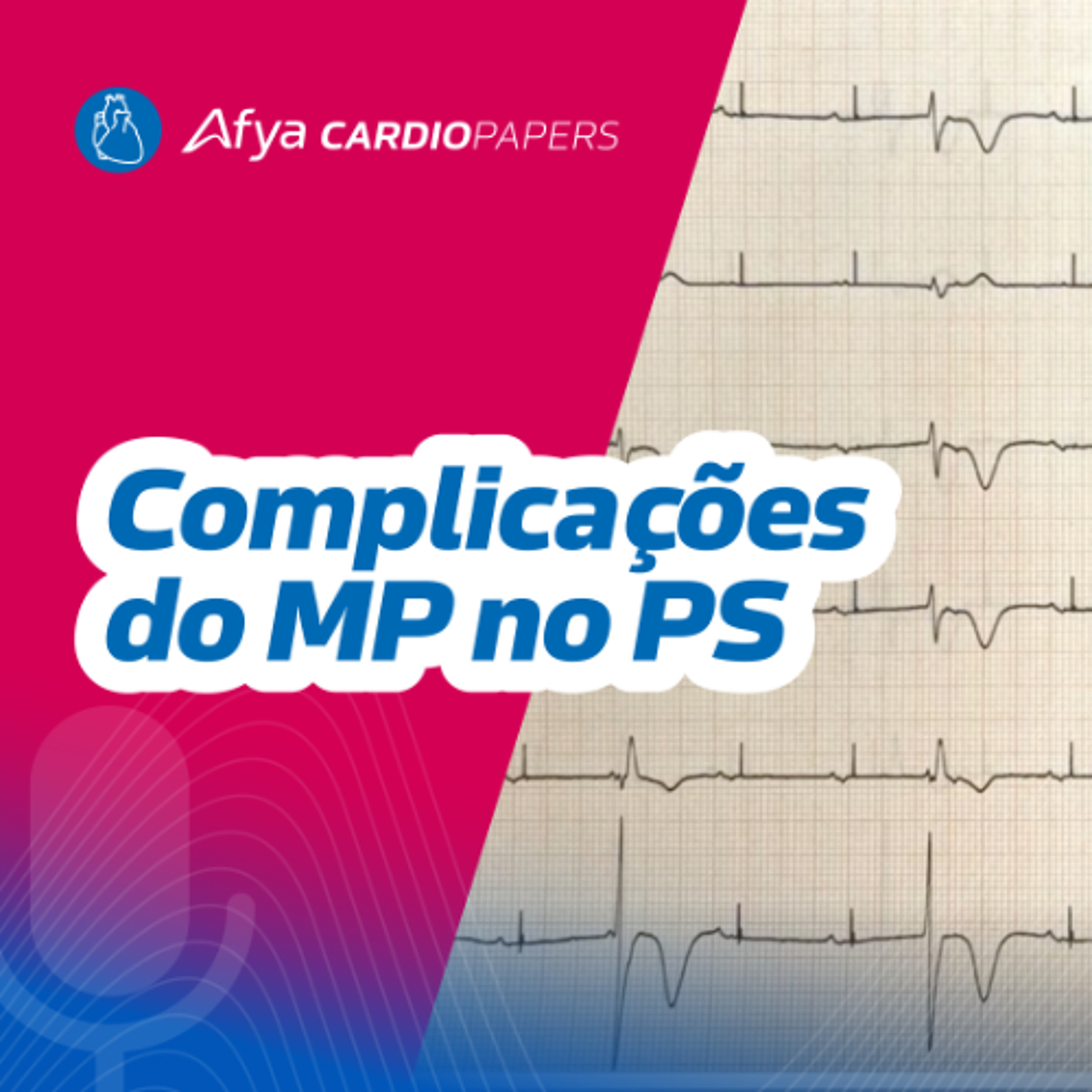 Complicações relacionadas ao Marcapasso na Emergência