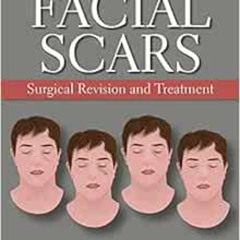 DOWNLOAD PDF 🗸 Facial Scars: Surgical Revision and Treatment by J. Regan Thomas,Davi