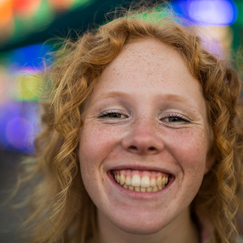 Balancing Your Smile – Fixing Tooth Gaps & Gummy Smiles