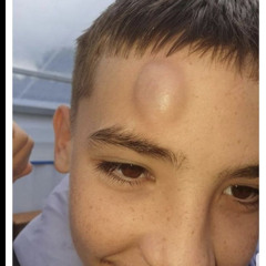 Broken Bones (Love Inc)-1