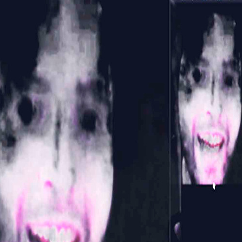hole heart ჭვრეტა prod.me
