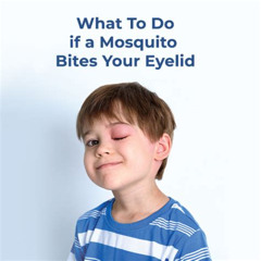 Best Mosquito Bite On Eye Treatment Reviews
