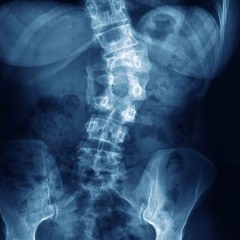 Phacemelt - Spine Splitter (CLIP)