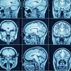 Have You Lost Your Mind?