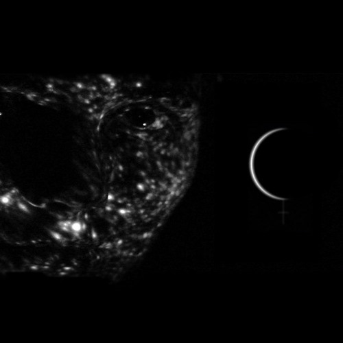 Noire la lune Under the