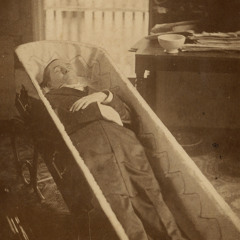 Embalming