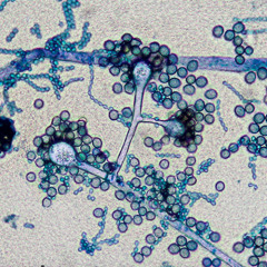 Tratamiento de las micosis