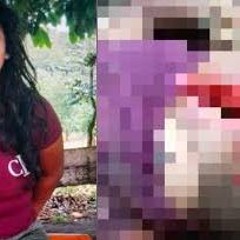 18!!! Video Da Menina Engoliu Lamina De Tres Pontas Portal Zacarias