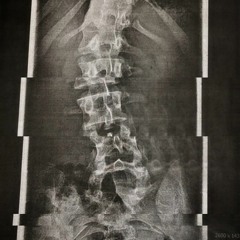 SPINAL