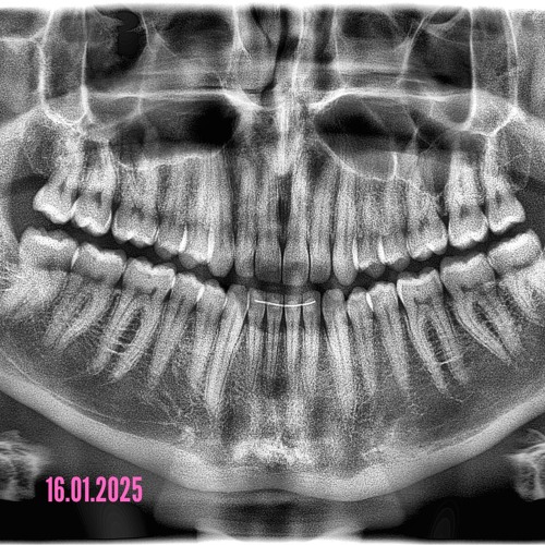 welcome to Synchronialand - 16/01/2025
