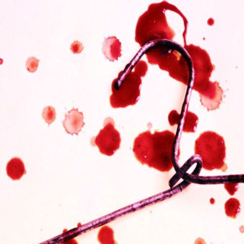 $tvxofcorpses x Mese - Abortion