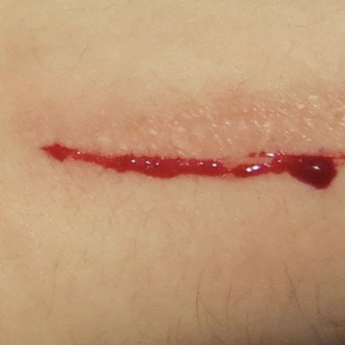 Stream Bleeding scar rough take by Stan Still | Listen online for free on  SoundCloud