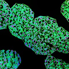 NCTalks with Gavin Giovannoni: advancements in the treatment landscape for multiple sclerosis