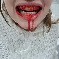 Bloody Teeth