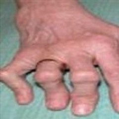 loh