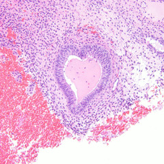 Pathologists against Trance