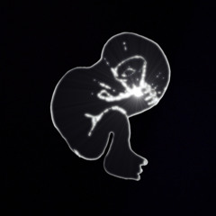 SALARNA — GNISTOR I OSS (SOM FYRVERKERI)