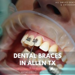 Understanding Orthodontic Braces: Types and Their Functions