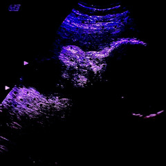 womb