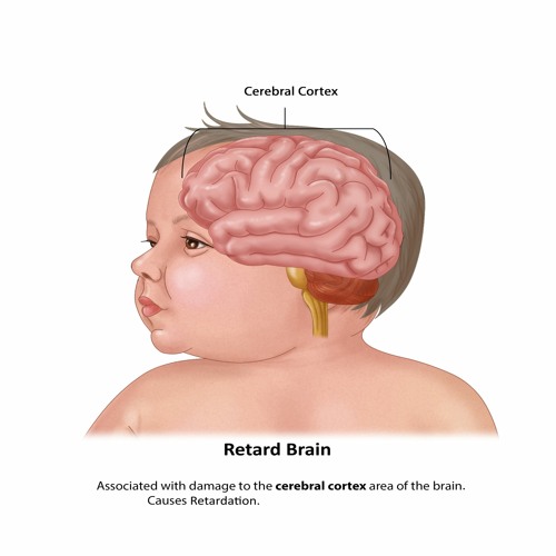 Retard Brain