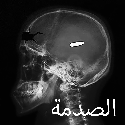 Trauma