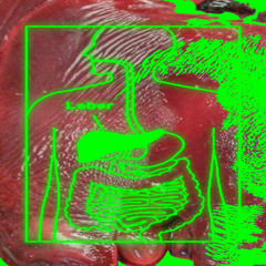 never_liked_liver_until_i_tasted_yours.gb[cirrhosis_overload]