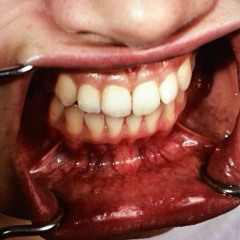 im fighting with my flesh