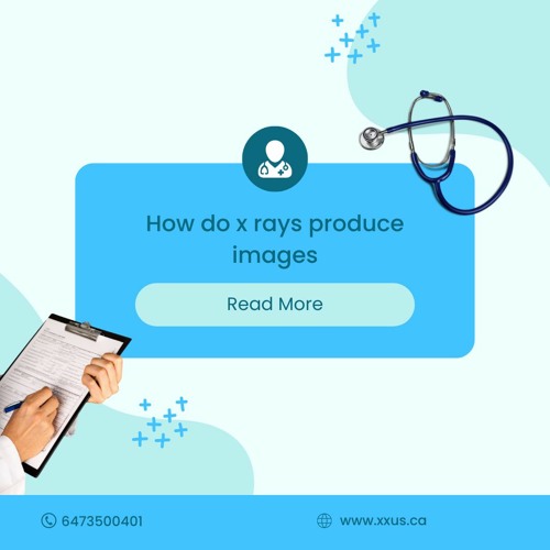 Stream episode How Do XRays Produce Images? by Xus Ca podcast Listen