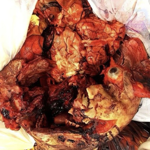 CORPSE VIOLATOR - Stab Wounds To The Face (feat. Sinizter)