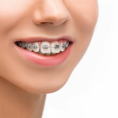 Orthodontic Tips for Getting the Best Treatment | George Campbell Orthodontist