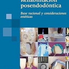 Read ebook [PDF] BERTOLDI:Rehabilitaci n Posendod ntica: Base racional y consideraciones estéti