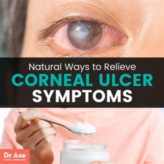 Best Treatment For Eye Ulcer Reviews