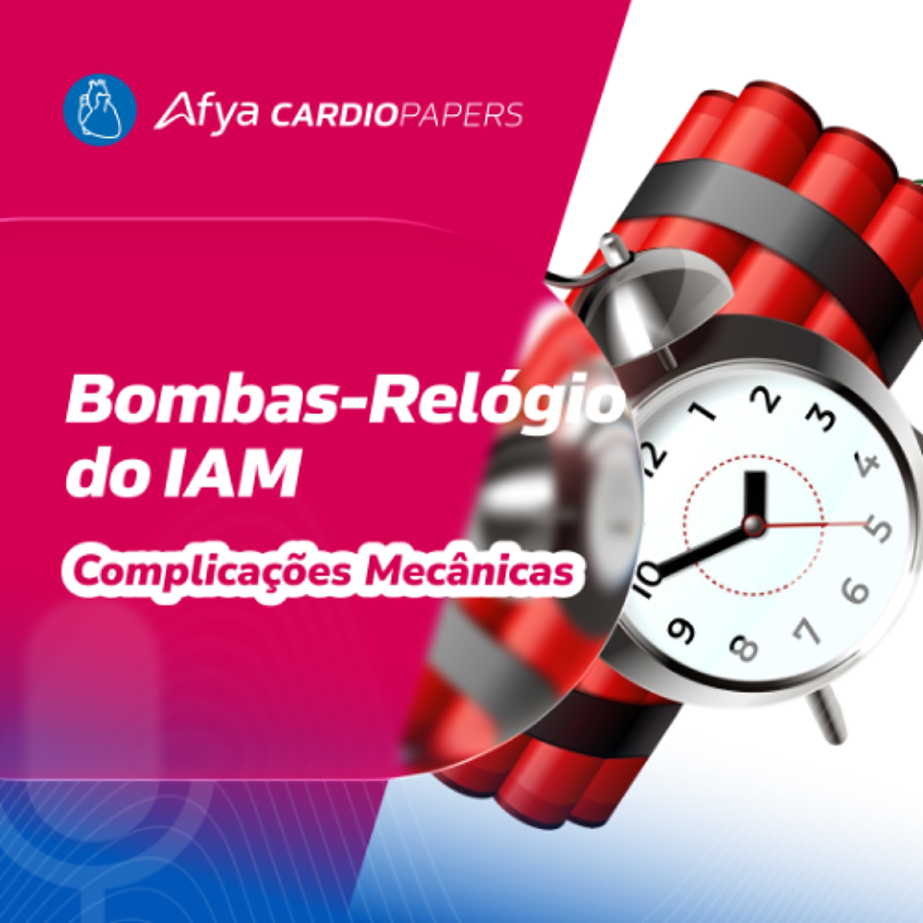Além da reperfusão no IAM: Por que as complicações mecânicas ainda matam