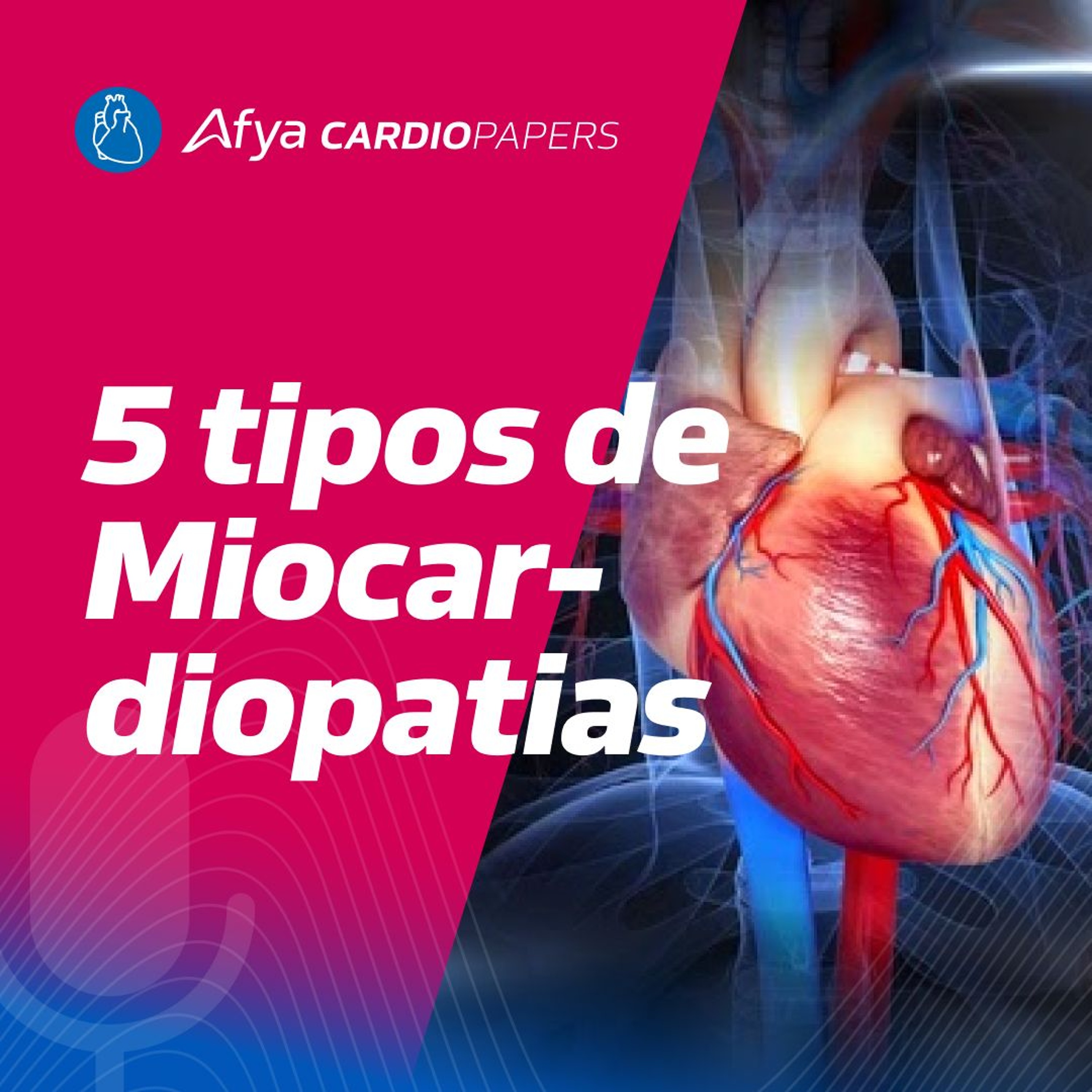 Quais os 5 fenótipos de iocardiopatias? episode artwork