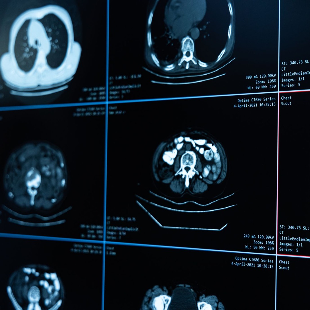 AI Podcast Series: Exploring the Crossroads of AI and Clinical Care
