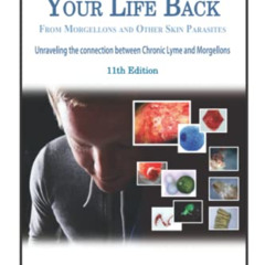 [READ] EBOOK ✏️ How to Get Your Life Back From Morgellons and Other Skin Parasites Li