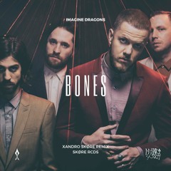 Imagine Dragons - Bones (Xandro Skøre Metal Cover)