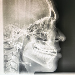 lil sweet thang [prod. Trapp XL]