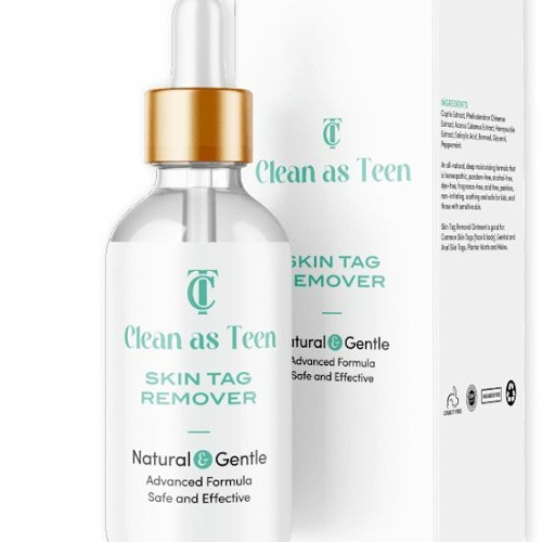 Stream how to safely remove skin tags by clean as teen skin tag