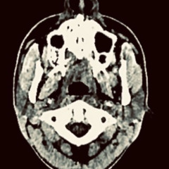 Alucinações com Belchior