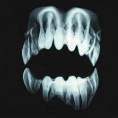 Tape6 - Sludge