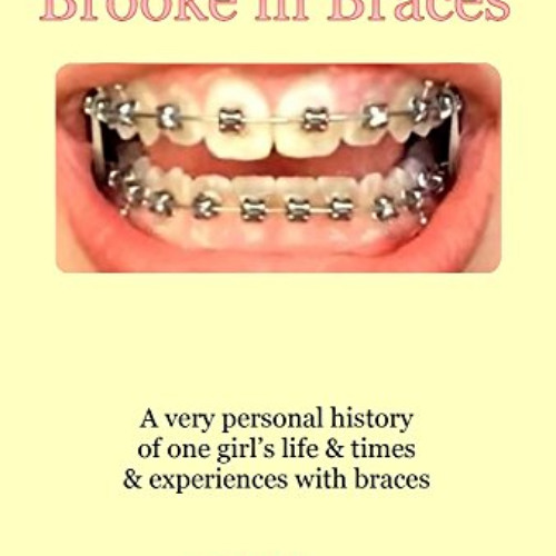[Access] KINDLE 💙 Brooke in Braces: A very personal history of one girl's life & tim