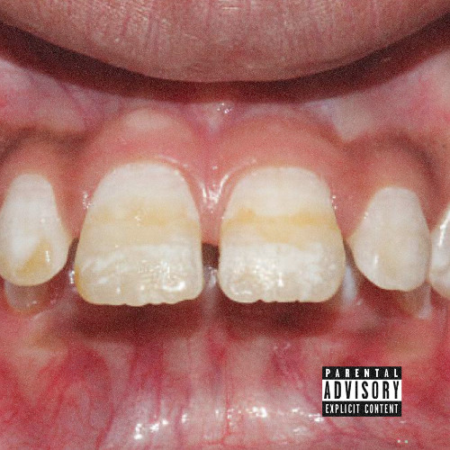 AVON (ft. DO$HA, NOMIDNIGHT, AD4M, NOPRODBLEM)