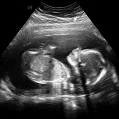 DON BERIDICKO -  YO TE AME