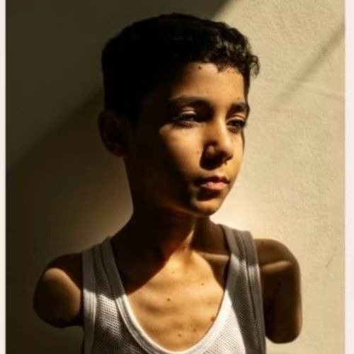 Amputees In Gaza (Thorn & The Rose)