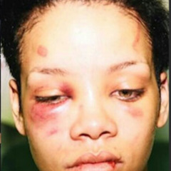 Fuck up Rihanna's umbrella